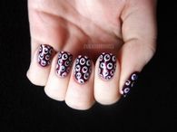 Bulging eyeballs nails