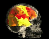 the brain