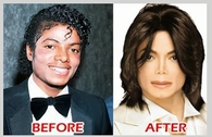 before and after surgery (clearly we know) Michael Jackson king of pop (RIP)